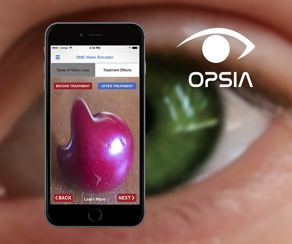 Mobile App For Vision Loss Prevention
<br> Developed the first mobile application OPSIA designed to simulate vision loss from diabetic eye disease to encourage preventative screening and early intervention.https://angio.org/